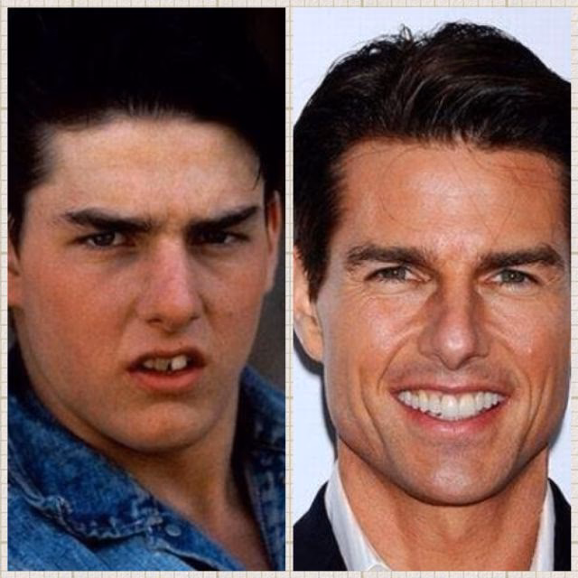 &iquest;Qu&eacute; se hizo Mickey Rourke?