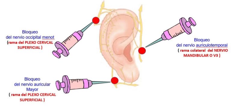 Gu&iacute;a Completa sobre la Reconstrucci&oacute;n de Oreja