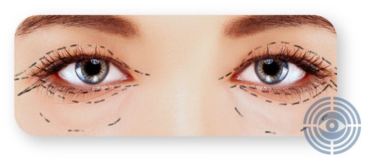 Cirug&iacute;a Ocular en Cali: Gu&iacute;a para Elegir Experto