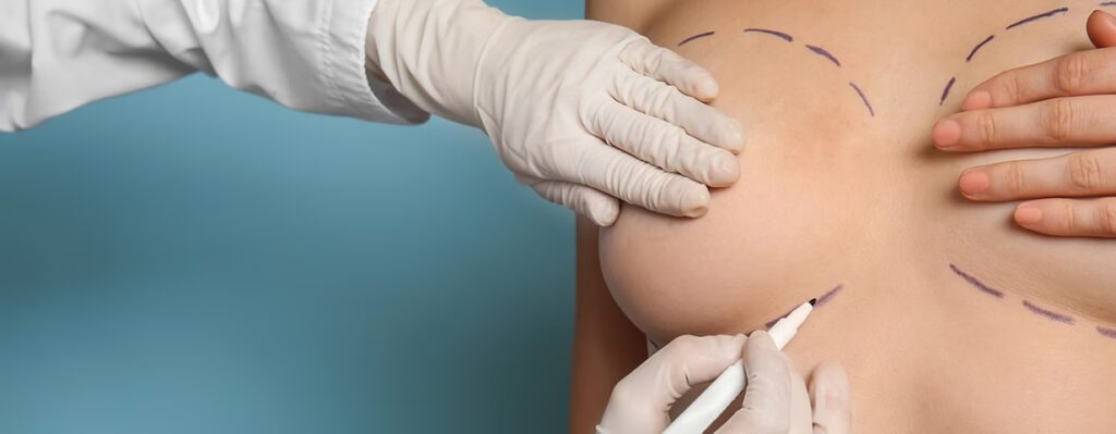 Cirugía Plástica: ¿Quién no es un buen candidato?