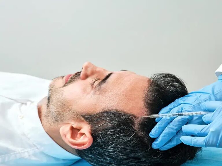 Cirug&iacute;a Capilar: &iquest;Alisado Profundo o Trasplante?