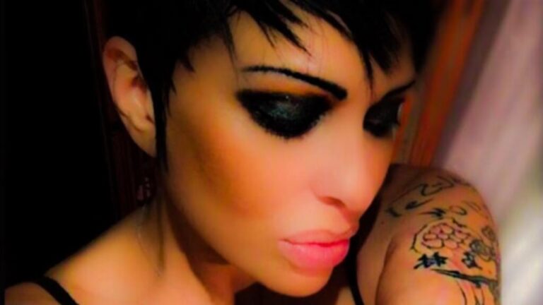 Cirug&iacute;as de Famosas: La Verdad de Cardi B