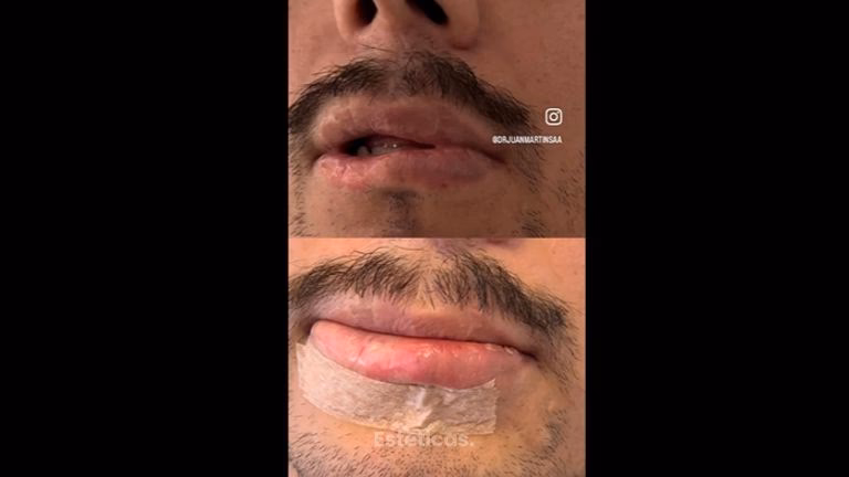 Cirug&iacute;a Est&eacute;tica Masculina: Gu&iacute;a Completa