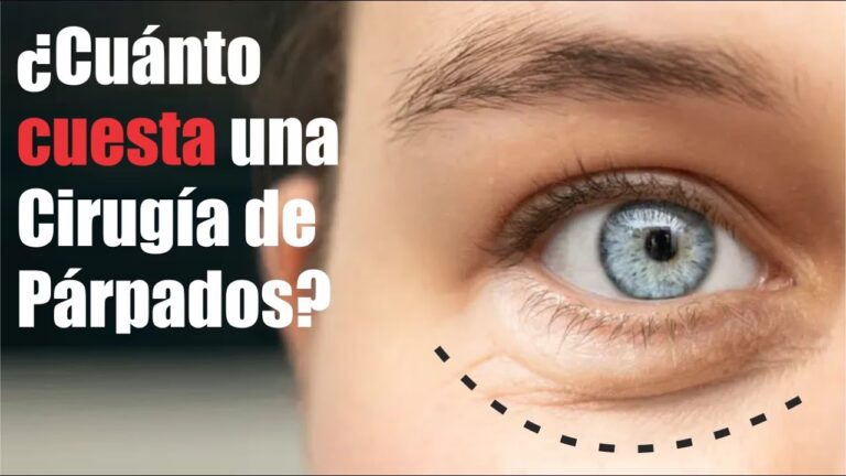 Blefaroplastia: Gu&iacute;a de Precios y Recuperaci&oacute;n
