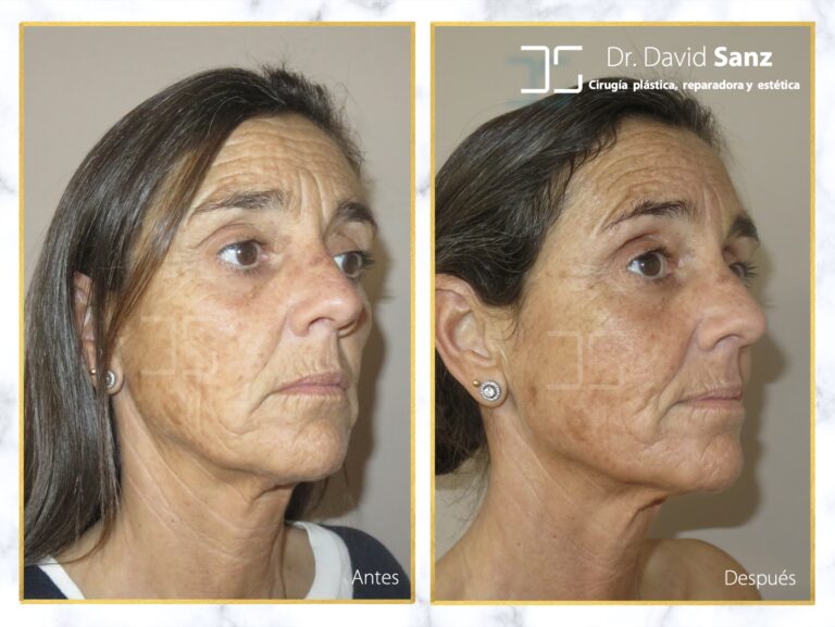 Formaci&oacute;n en Cirug&iacute;a Pl&aacute;stica en EEUU: Duraci&oacute;n y V&iacute;as