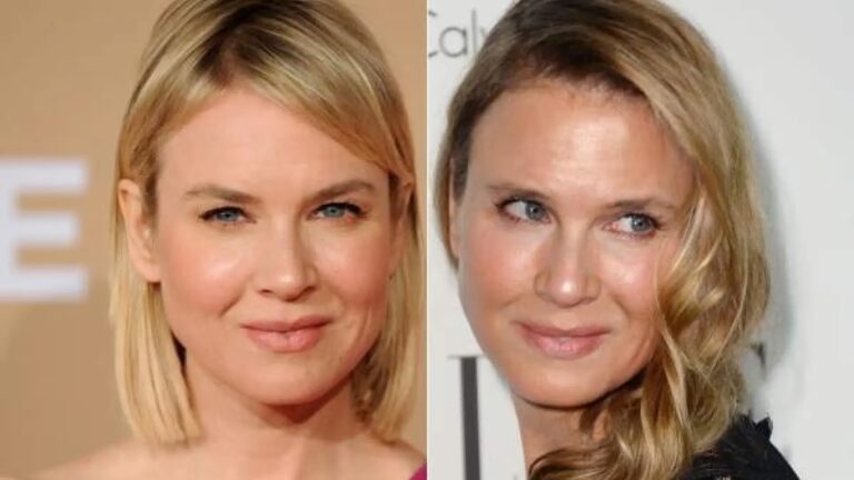 El Misterio del Rostro de Ren&eacute;e Zellweger