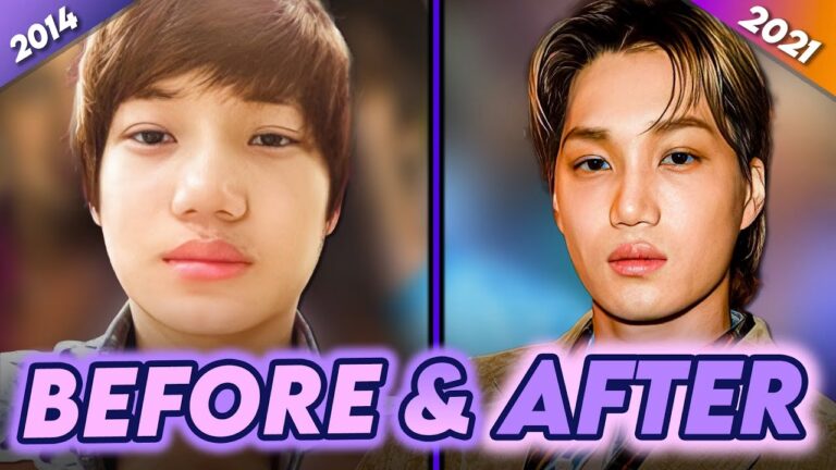 K-Pop y Cirug&iacute;a: El Est&aacute;ndar de Belleza de los &Iacute;dolos