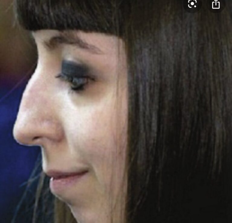 Flor de la V y la Vaginoplastia: Su Decisi&oacute;n