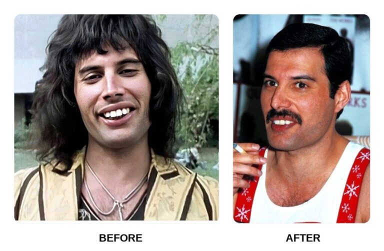 La Sonrisa de Freddie Mercury: El Secreto de su Voz