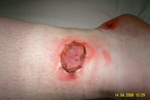 Regenera tu Piel: Guía para una Epidermis Sana