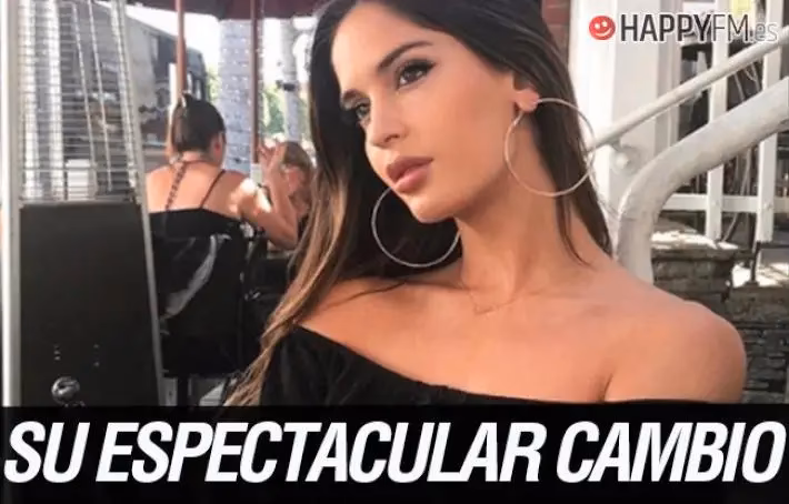 &iquest;Qu&eacute; cirug&iacute;a se hizo Natalia?