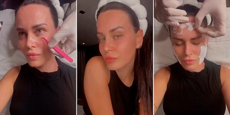 Donatella Versace: El rostro de la transformaci&oacute;n